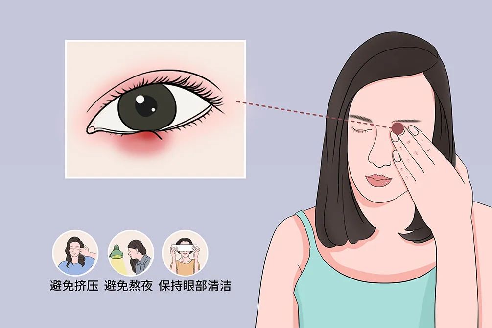 热敷2